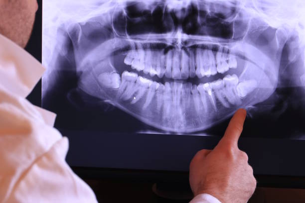 Best Emergency Root Canal Treatment in Gman, IL